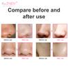 Multi-functional Cleaning Blackhead Remover Pore Acne Pimple Removal Face T Zone Nose Cleaner Vacuum Suction Facial Beauty Devi