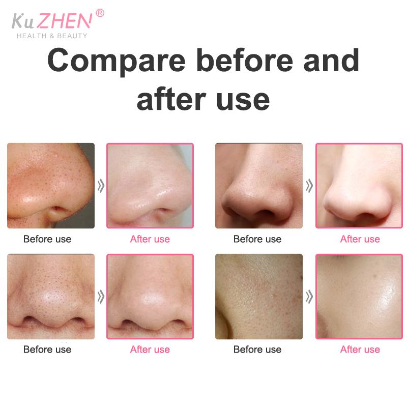 Multi-functional Cleaning Blackhead Remover Pore Acne Pimple Removal Face T Zone Nose Cleaner Vacuum Suction Facial Beauty Devi