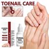 Nail Repair Solution 15ml Deep Nourishing Cuticle Treatment For Strong Glossy Nails Fast Absorbing Non Sticky Portable Care
