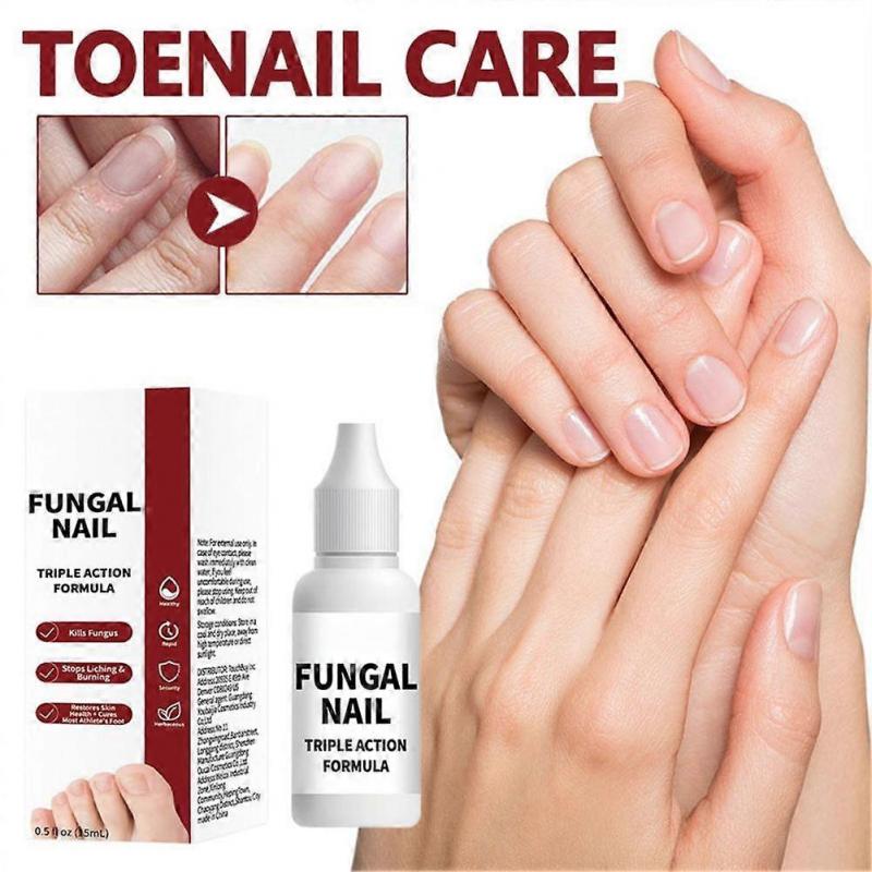 Nail Repair Solution 15ml Deep Nourishing Cuticle Treatment For Strong Glossy Nails Fast Absorbing Non Sticky Portable Care
