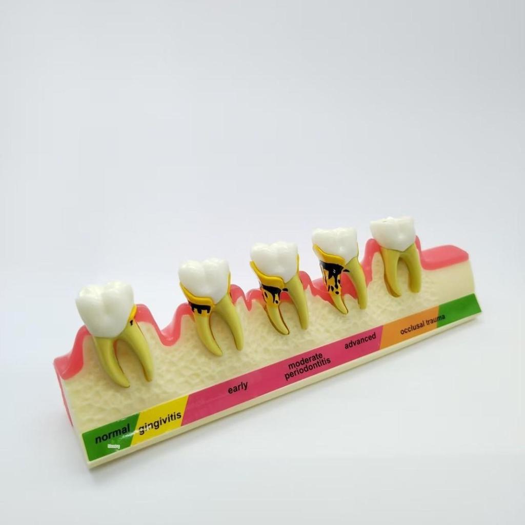 PH4010 Periodontal Classification Model: Dental Mold for Subgingival Calculus Scaling