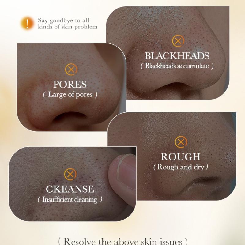 10pcs Rice Puree To Remove Blackhead Nasal Mask, Clean Nose Blackhead Nasal Sticker Skin Care Products