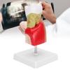 Dental Caries Tooth Model Dental Teeth Model for Teaching Training Patient Education