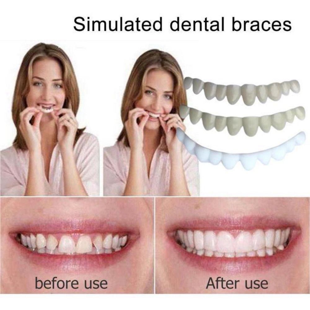 6Pcs Natural Shade Denture Temporary Filling Kit Upper Veneer Cosmetic Tooth  Home