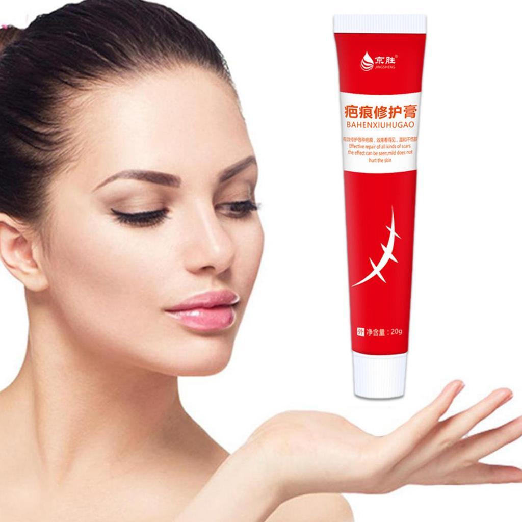 20 г крем для удаления шрамов от акне, хирургическое удаление растяжек, гель для кожи лица, отбеливающий пигментацию тела, Sm U4P9