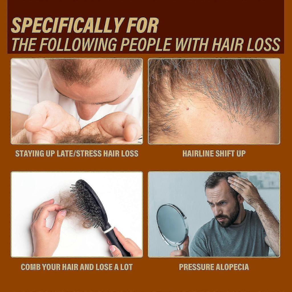 OUHOE Ginger Hair Growth Essence 6ml, Universal Hair Treatment, Moisturizing & Repairing, Strengthens Hair Roots, Anti-Hair Loss