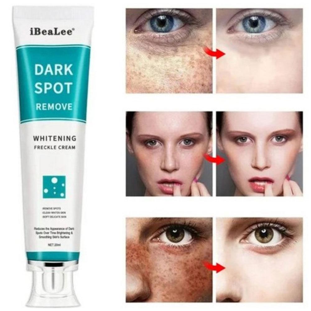 

SMIATEY 1+1 Крем для удаления пигментных пятен Vita e Whitening Cream Cream Age Spot Blemishes 20 мл 1 шт., 2 контейнера, 20 г