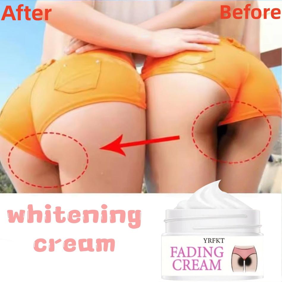 Vitamin E Moisturizing and Whitening Cream - Reduces Melanin, Brightens and Tightens the Skin, and Improves Dry and Peeling Skin