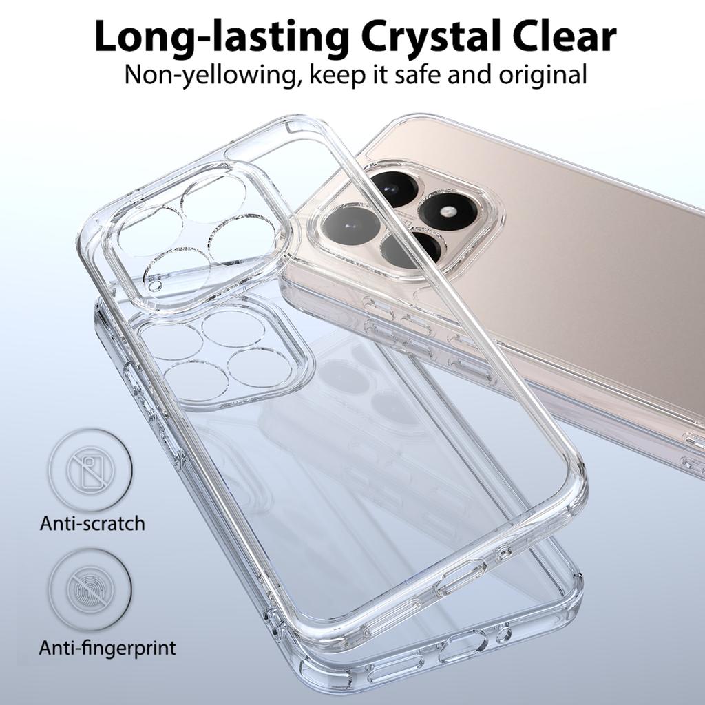 For Xiaomi 17 Clear Phone Case TPU+Acrylic Shockproof Phone Back Cover