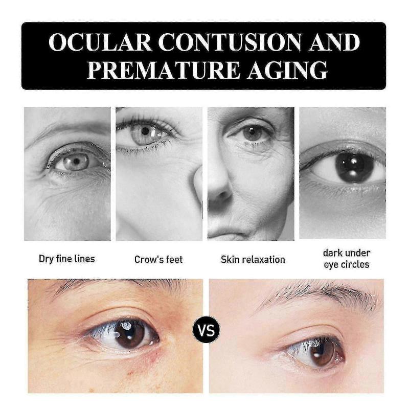 1pc Ouhoe Snake Venom Peptide Moisturizing Eye Cream Moisturizing, Lightening Fine Lines, Anti-aging And Anti-wrinkle | | 1PC