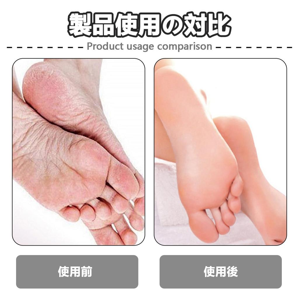 TokTech Ferse Ferse und Hornhaut Hergestellt aus Nano Set aus Ferse und Fußsohle des Vollständig Etui enthalten Feile, Feile, Entferner, Glas, 2, Pflege, Peeling, Fuß,