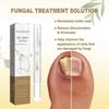 West & Month Nail Care Solution Hand And Foot Nail Cleaning Nail Care Solution