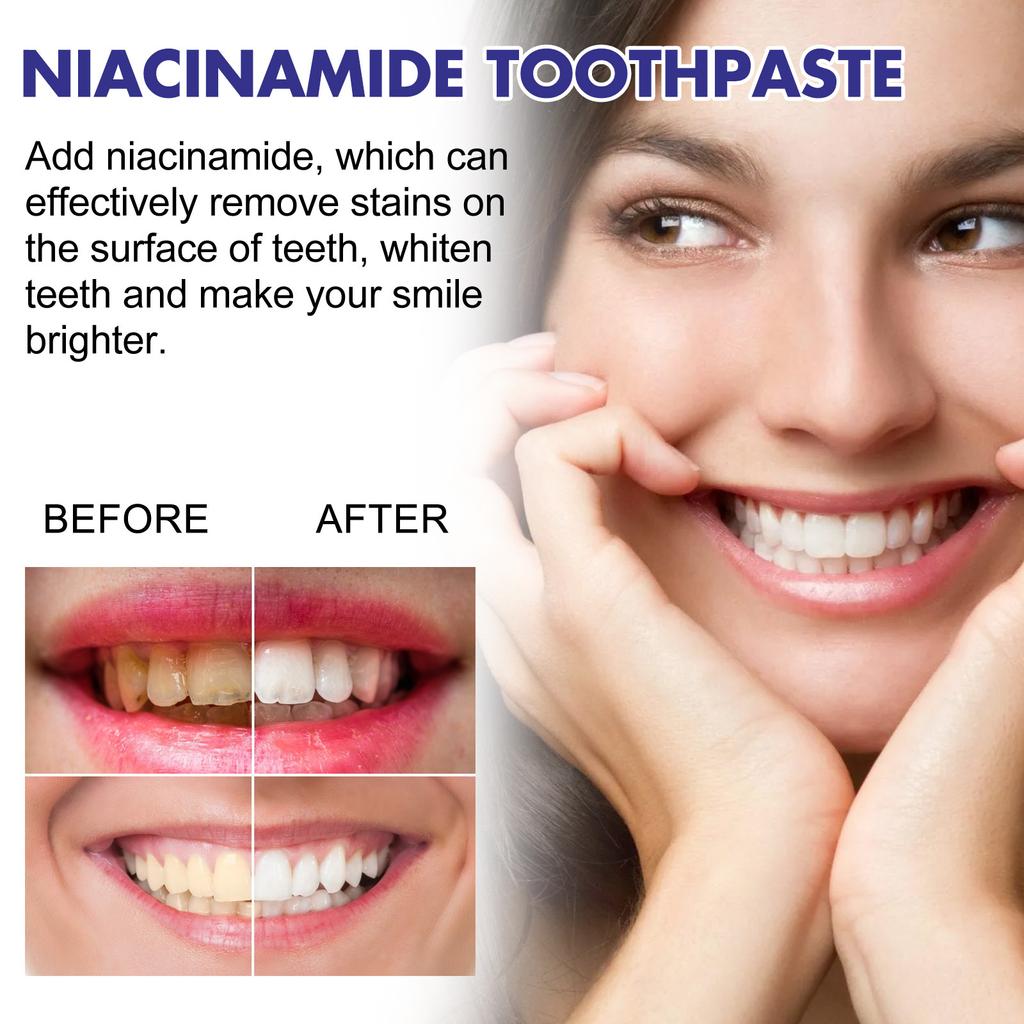 EELHOE Teeth Cleansing Whitening Mousse Deep Cleaning Toothpaste Foam Toothpaste Removes Stains Fresh Breath Dental Care Tools 100g