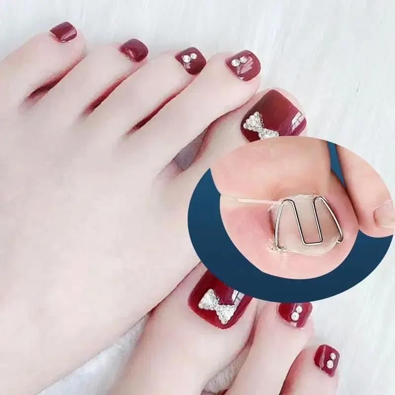 Nagelkorrekturdraht, Gerät zur Korrektur eingewachsener Nägel, Nagelschneiden, Korrekturdraht für eingewachsene Nägel, Zehennagelkorrekturhaken