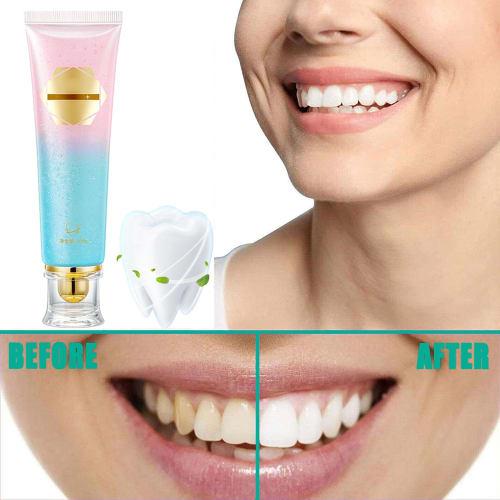 Niacinamide Whitening Toothpaste, Stain-Removing Whitening Toothpaste, Foaming Toothpaste for Children, Oral Cleansing, Removes Teeth Stains and Bad B