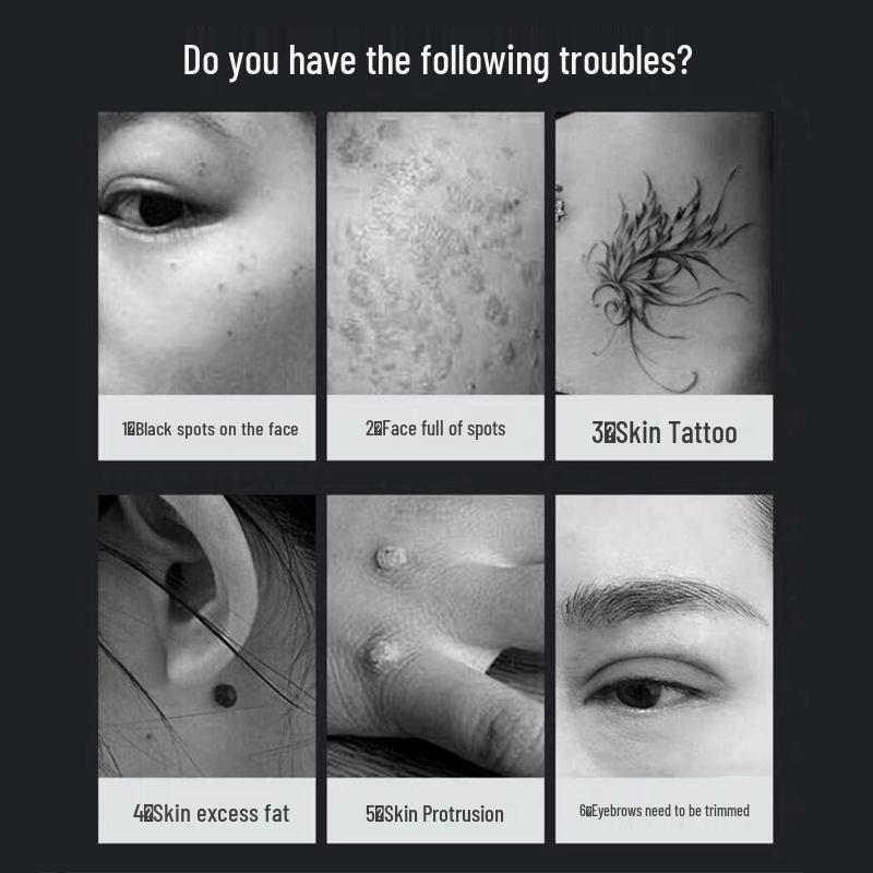 Portable Picosecond Laser Pen for Tattoo, Freckle, and Eyebrow Removal with Red & Blue Light