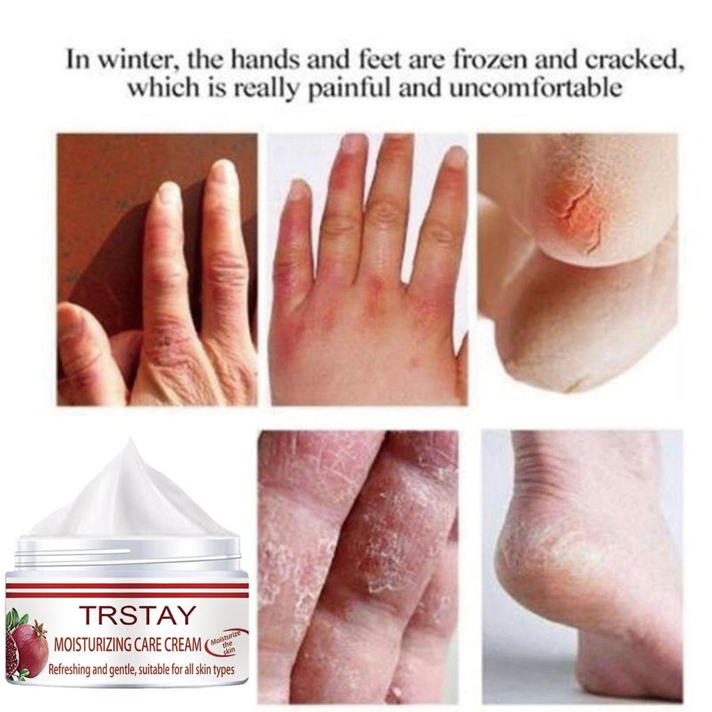 Sprukket Reparasjon Fjern Callus Dead Skin Care Antitørrmaske Eksfolierende sokker Føtpleie Fotbehandling