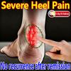 Soothing Cream for Heel Pain, Achilles Tendon Pain