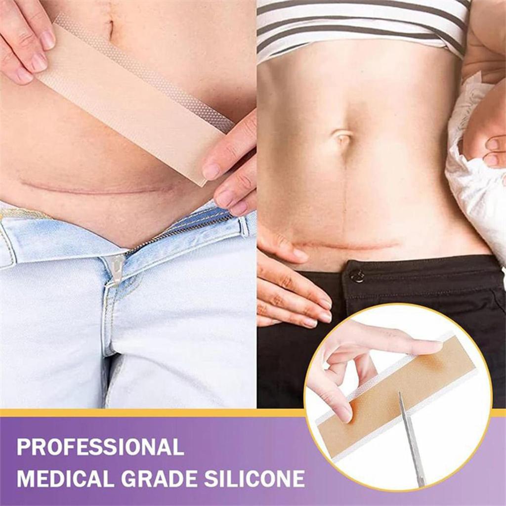 Soft Silicone Gel Scar Sheet for Acne Trauma Burn Scar Removal Skin Repair Ear Beauty Treatment