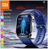 2025 Xiaomi ECG+PPG AI Health Diagnose Smart Watch Men Women Clock Blood Lipid BP Uric Acid Heart Rate Tracker For Xiaomi Smartwatch