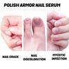 Ouhoe Nail Care Solution - Repairs Ingrown, Damaged, And Soft Nails, Nourishing And Brightening Nail Care Liquid For Hands And Feet