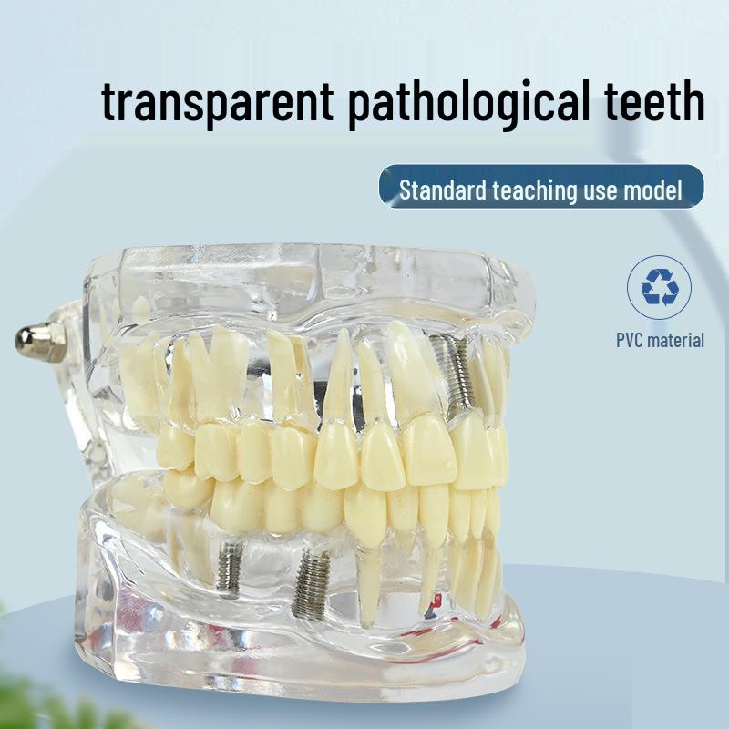 Children's Dental Teaching Aid: Tooth Brushing Toy Model