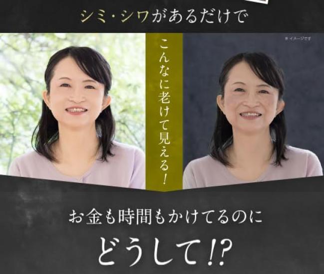 Kimie Wrinkle White Medicated Cream [Quasi-drug] All-in-One (Contains Niacinamide, Quasi-drug)