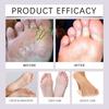Antiperspirant Spray, Foot Odor Removal And Antiperspirant Spray, Foot Care Spray,30ml