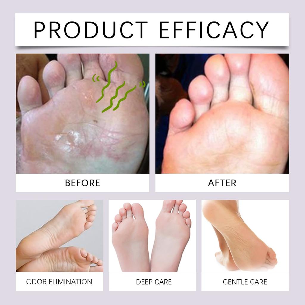 Antiperspirant Spray, Foot Odor Removal And Antiperspirant Spray, Foot Care Spray,30ml