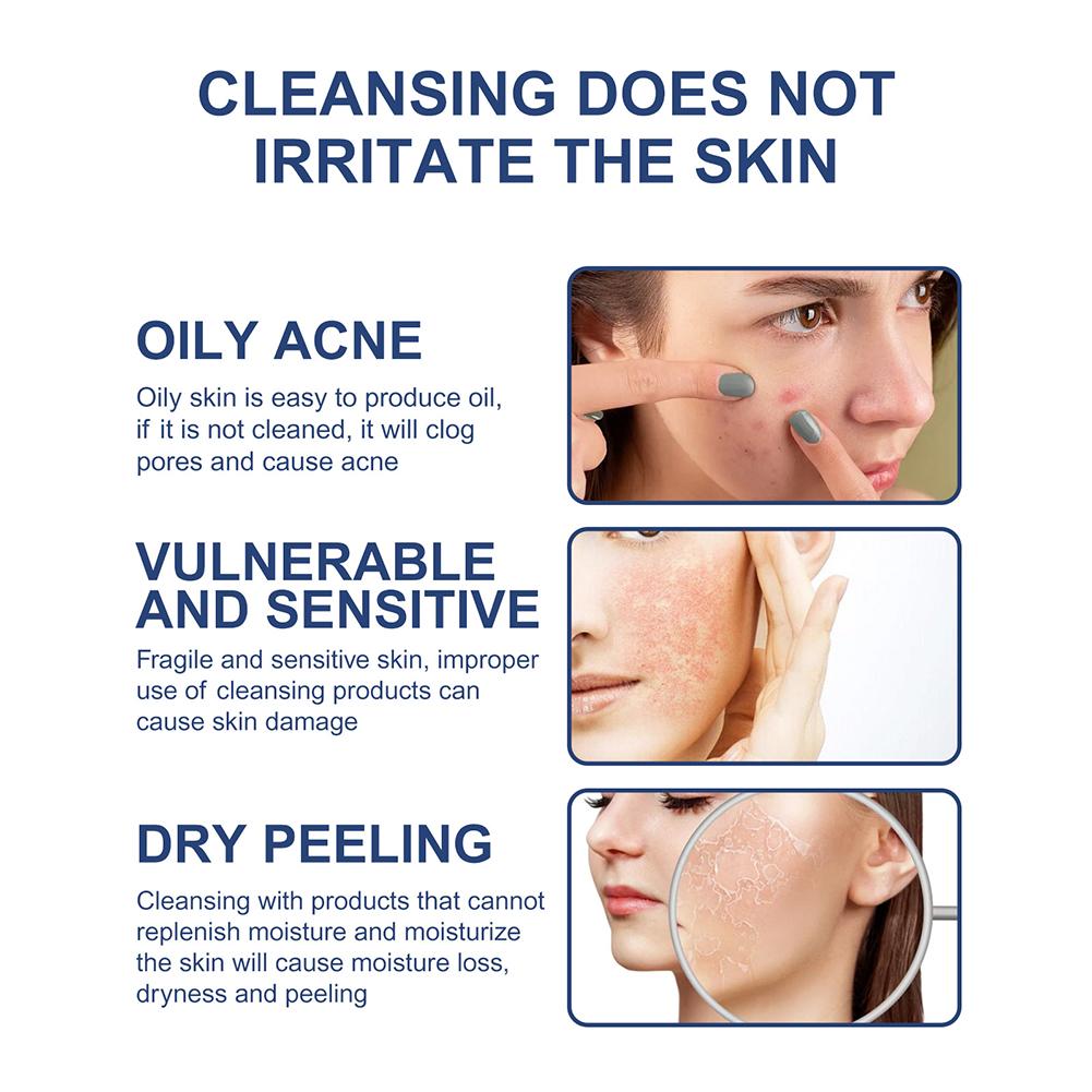 Whitening Freckle Removing Facial Cleanser Fade Dark Anti-Acne Cleansing Skin Brighten Spots Mo J6Y9