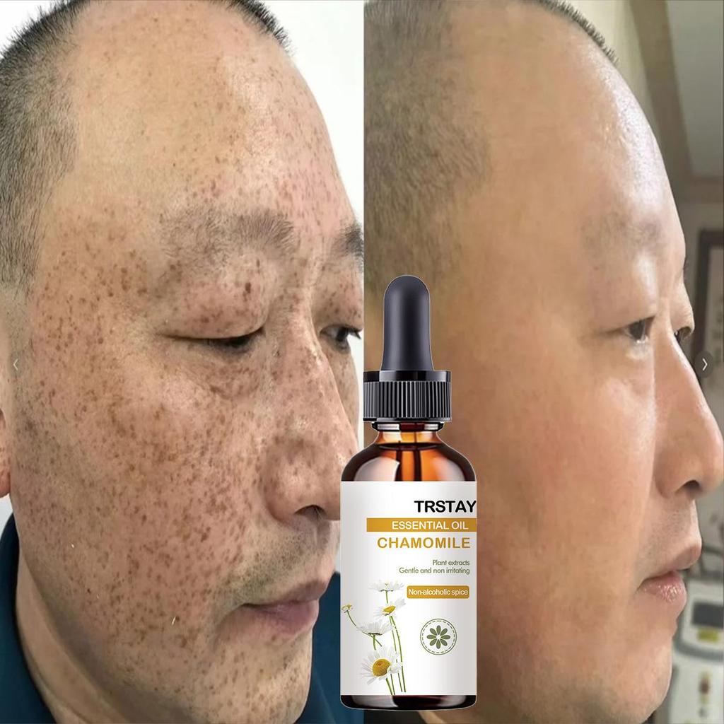 Dark Spot For Face, Dark Spot Corrector Cream, Ingredient, Enriching Skin Care For All Skin Tones, Melasma, Freckle, Sun Spot Improving