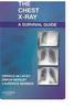 Chest X-Ray A Survival Guide A Survival Guide Paperback IND-21