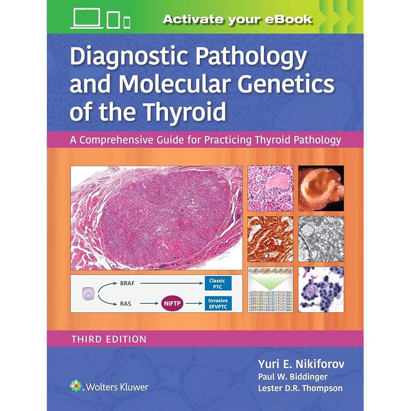 Diagnostic Pathology And Molecular Genetics Of The Thyroid A Comprehensive Guide For Practicing Thyroid Pathology 3Ed (Hb 2020)