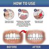 3 Pezzi Gel Terapia Gengivale, Gel Lenitivo Istantaneo per Denti Sensibili e Cura delle Gengive