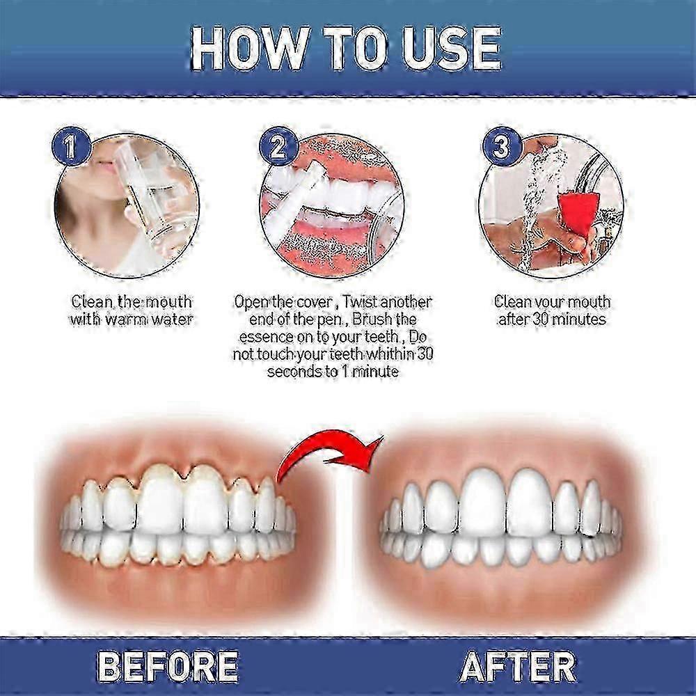 3 Pezzi Gel Terapia Gengivale, Gel Lenitivo Istantaneo per Denti Sensibili e Cura delle Gengive