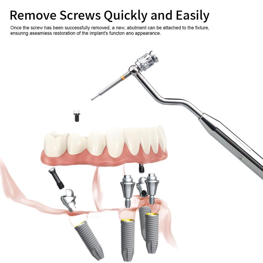 1 Satz Dentalimplantat-Entfernungsset, Beschädigter Schraubenextraktor-Satz, Universelle Implantat-Prothetik-Kits für die Klinik
