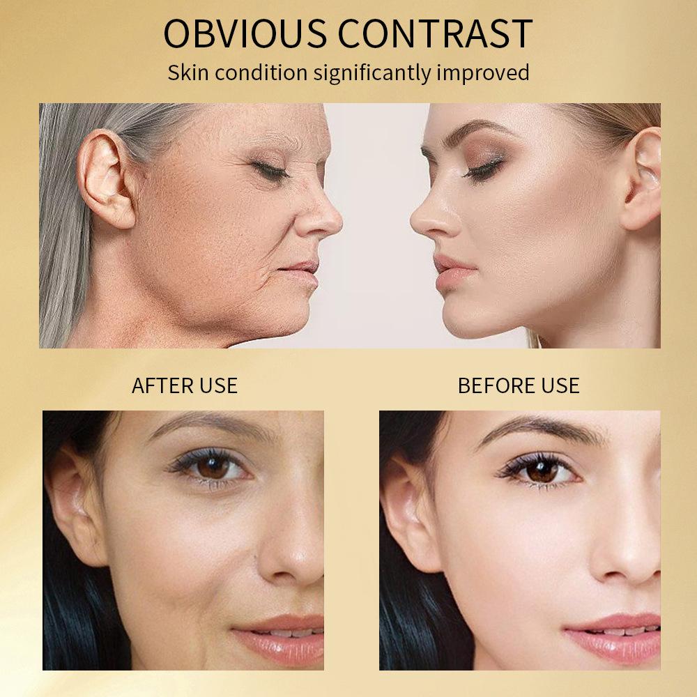 Niacinamide Stock Solution Moisturizing Anti-wrinkle Light Grain Essence