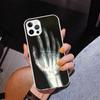 Autumu X Ray Hand Bones Phnoe Case for Iphone 17 Air 16 16E 11 12 13 Mini 14 Plus 15 Pro Max 7 8 + SE 2020 Phone Cover Coque