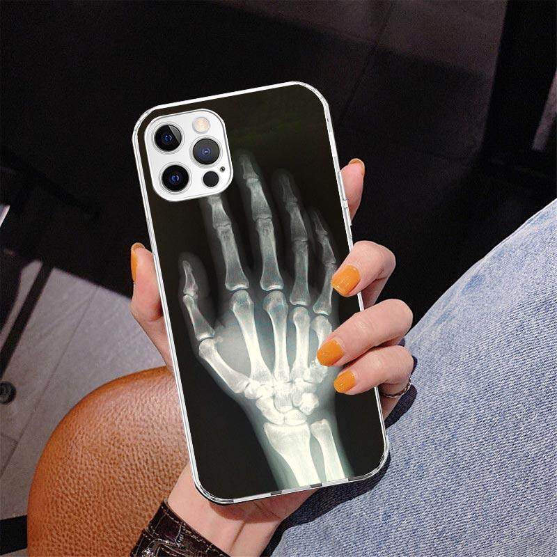 Autumu X Ray Hand Bones Phnoe Case for Iphone 17 Air 16 16E 11 12 13 Mini 14 Plus 15 Pro Max 7 8 + SE 2020 Phone Cover Coque