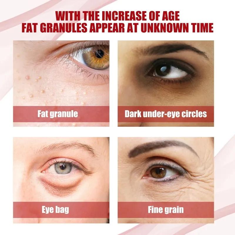 Crema Occhi Curcuma Retinolo Anti Occhiaie Rassodante Pelle Sbiadisce Linee Sottili Siero Stick Riparazione Istantanea Occhi per la Cura degli Occhi delle Donne