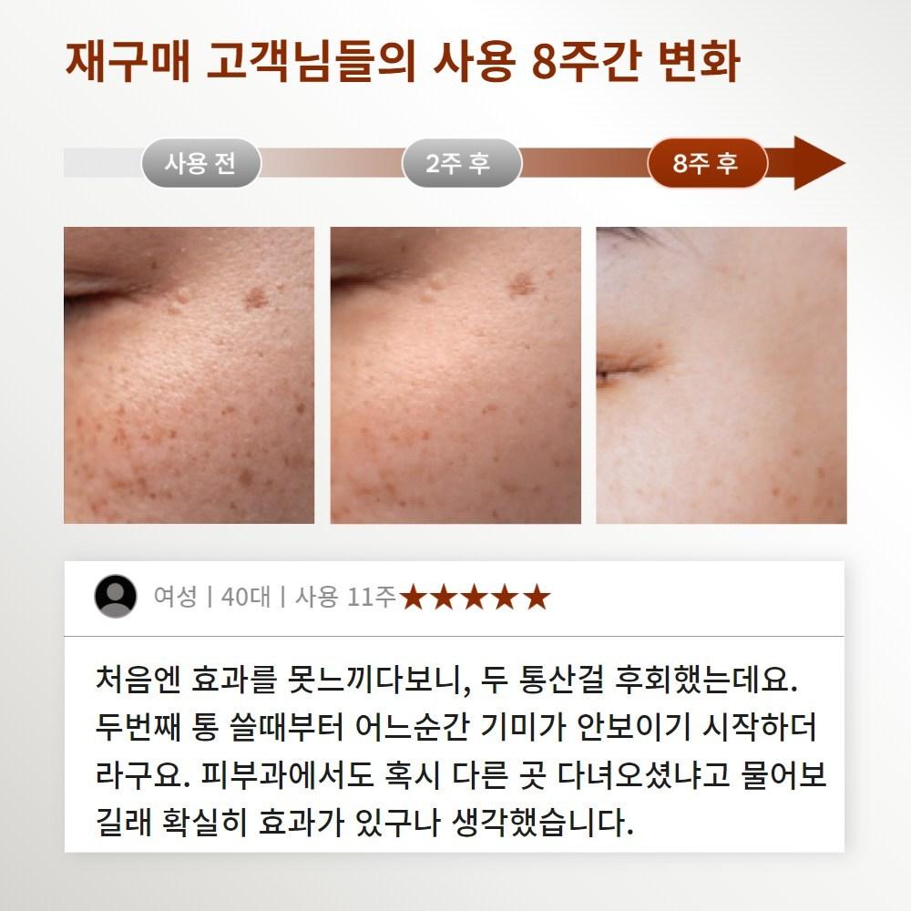 Wizard Choseon Yeast Balm Tranexamic Acid Pharmacy Blemish Cream Large-capacity Blemish Cream, 100ml, 1 Unit