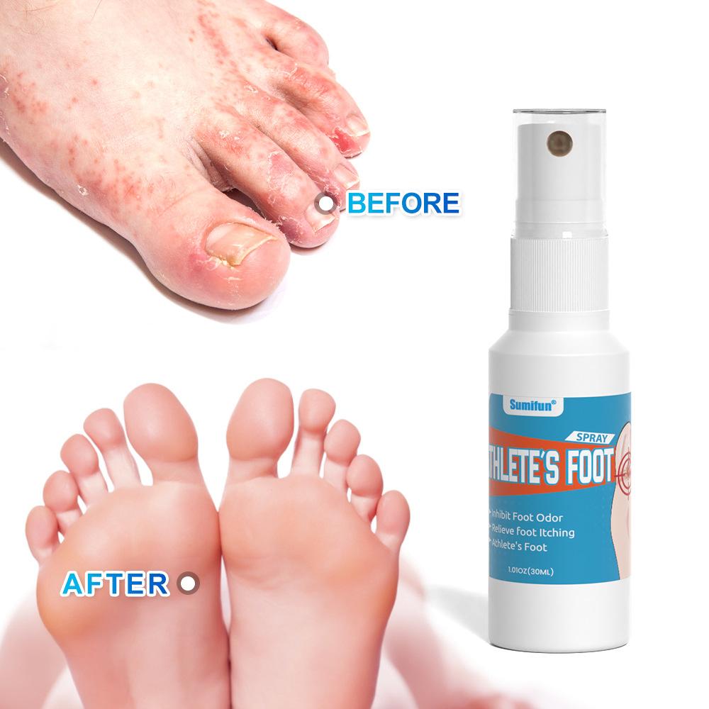 Sumifun 30/60/150ML Relieve Foot Odor Spray Foot Sweating Toe Anti-Itching Summer Essential Exercise Foot Care Bacteriostat Liquid Spray