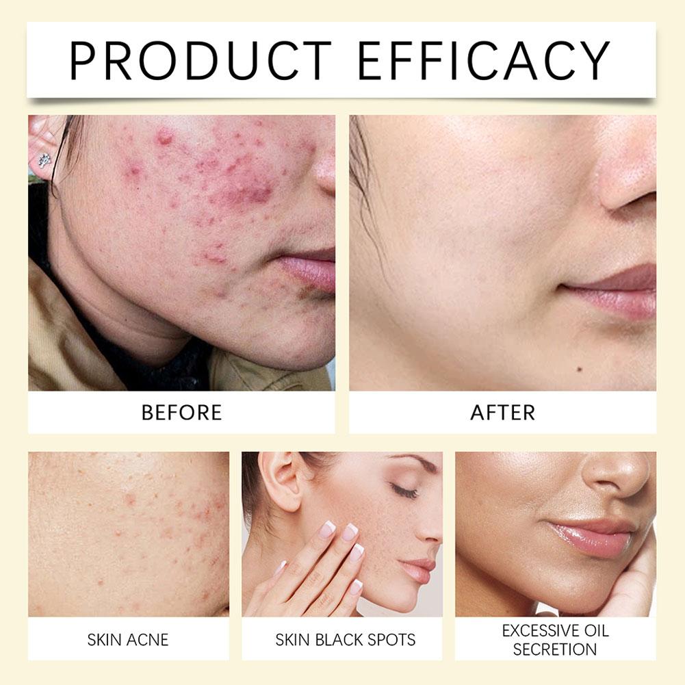 Turmeric Facial Cleansing Pads Exfoliating Makeup Removal Wipes Dead Skin Peeling Tool Smooth Skin Shrink Pores Gentle