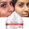 A Hydrating Moisturizing Cream To Make It Look Smoother and Less Wrinkled, an Essential Part of Your Daily Facial