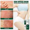 1-5x Ringworm Treatment - Ringworm Cream- Relieves Itching - Cream Antimicrobial and Antifungal- Fast Acting Tinea Itch Relief,20g