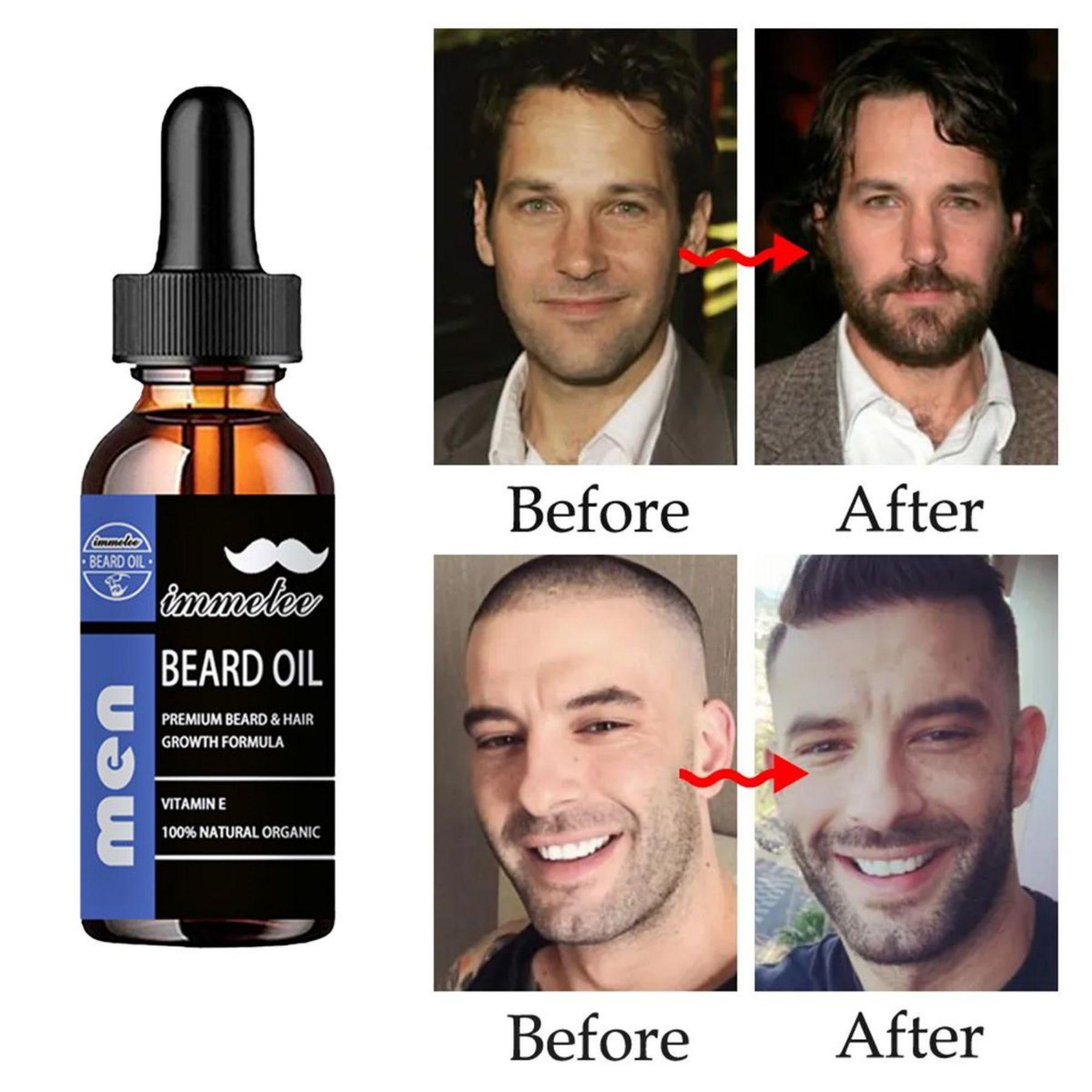 

Эффективный уход за кожей. Восстанавливающее средство. Масла для роста бороды. Масло для восстановления волос.