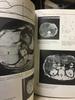 [USED] Diseases of the Liver and Biliary Medical Books