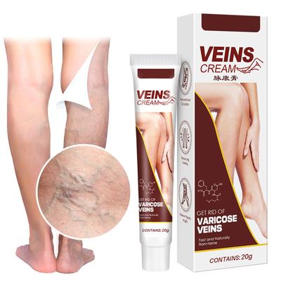 Varicose Vein Cream,v K Cream Vein Cream For Legs  Varicose Veins For Legs 20g