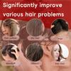 Deep Cleansing Scalp Hair Loss And Oil Control Shampoo Soap 60g, Rosmarinus Officinalis Shampoo Solid Shampoo Soap
