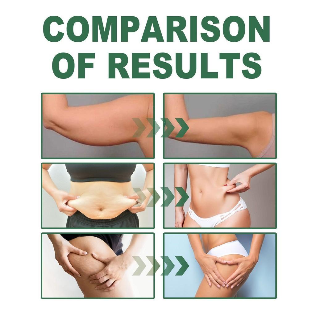 Oceaura Collagen Boosting Body Oil Hydrating Moisturizing And Firming Skin Care Solution 100ml